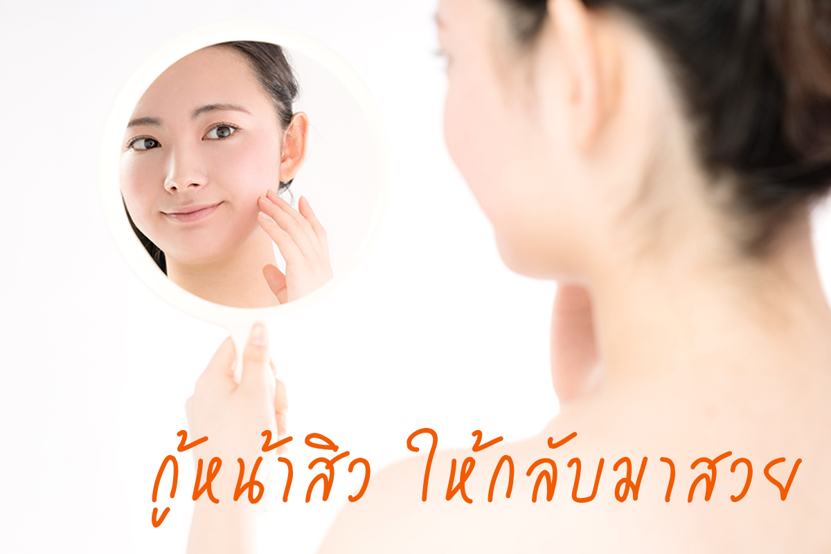 สิว กู้ได้