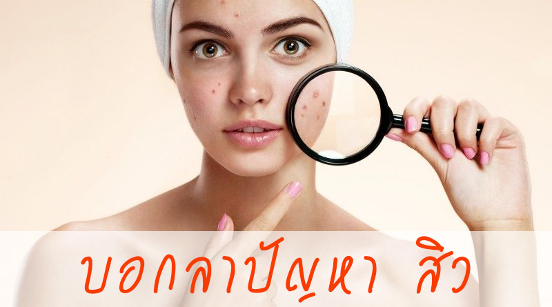 สิว เกิดจากอะไร