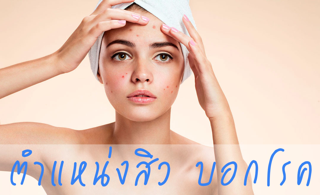 สิว บอกโรค
