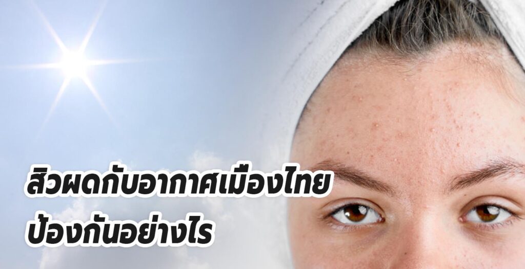 สิวผด กับอากาศ