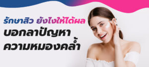 รักษาสิว ยังไงให้ได้ผล