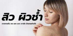 สิว ผิวช้ำ