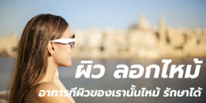 ผิว ลอกไหม้