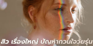 สิว เรื่องใหญ่