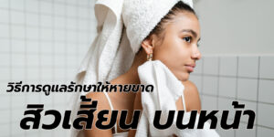 สิวเสี้ยน บนหน้า