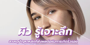 ผิว รู้เจาะลึก