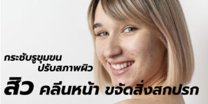 สิว คลีนหน้า