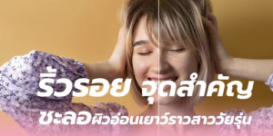 ริ้วรอย จุดสำคัญ