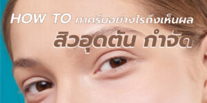 สิวอุดตัน กำจัด