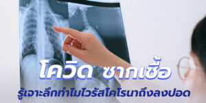 โควิด ซากเชื้อ