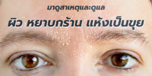 ผิว หยาบกร้าน