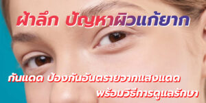ฝ้าลึก กันแดด
