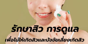 รักษาสิว การดูแล