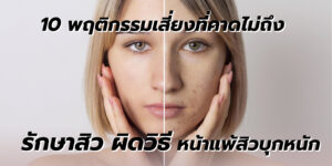 รักษาสิว ผิดวิธี