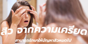 สิว จากความเครียด