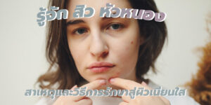 รู้จักสิว หัวหนอง