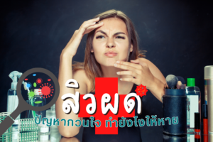 สิวผด ปัญหากวนใจ ทำยังไงให้หาย