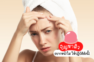 ปัญหาสิว อยากหน้าใส ให้ปฏิบัติดังนี้!