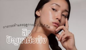 การกระทำและฤดูการณ์ ที่ก่อให้เกิด สิว ปัญหาผิวพัง