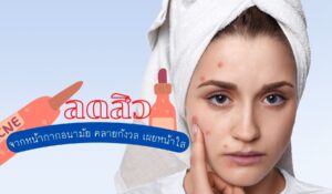 วิธีลดสิวจากหน้ากากอนามัย คลายกังวล เผยหน้าใส