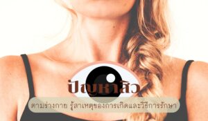 ปัญหาสิว ตามร่างกาย รู้สาเหตุของการเกิดและวิธีการรักษา