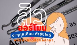 สิวฮอร์โมน ปะทุทุกเดือน ทำยังไงดี พร้อมบอกวิธีดูแลรักษา