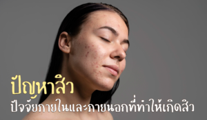 ปัญหาสิว ปัจจัยภายในและภายนอกที่ทำให้เกิดสิว