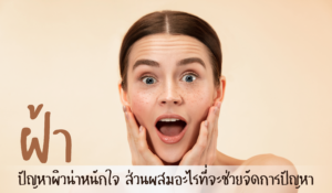 ฝ้า ปัญหาผิวน่าหนักใจ ส่วนผสมอะไรที่จะช่วยจัดการปัญหา