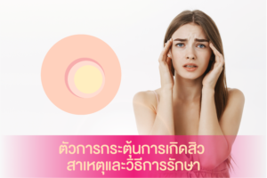 ตัวการกระตุ้นการเกิดสิว สาเหตุและวิธีการรักษา