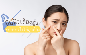บีบสิวเสี่ยงสูง รักษายังไงให้ถูกต้อง
