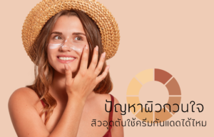 ปัญหาผิวกวนใจ สิวอุดตันใช้ครีมกันแดดได้ไหม