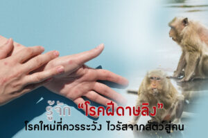 รู้จักโรคฝีดาษลิง โรคใหม่ที่ควรระวัง ไวรัสจากสัตว์สู่คน