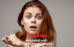 สิวเสี้ยนศัตรูของผิวหน้า มาดูวิธีจัดการให้หมดไป