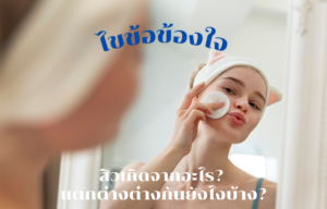 ไขข้อข้องใจ สิวเกิดจากอะไร? แตกต่างต่างกันยังไงบ้าง?